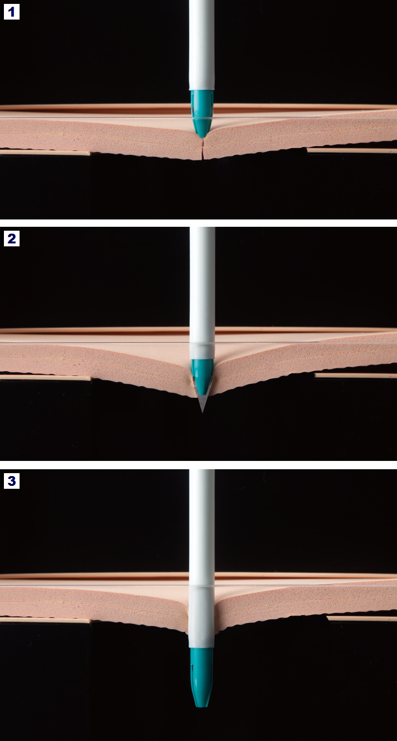 Needle Protection during puncture