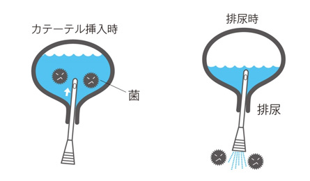 img-catheterization_merit03.jpg