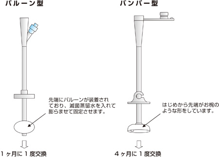 カテーテルの種類図